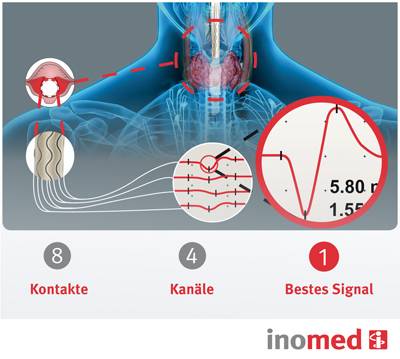 Intelligente Technologie f&uuml;r neue Impulse